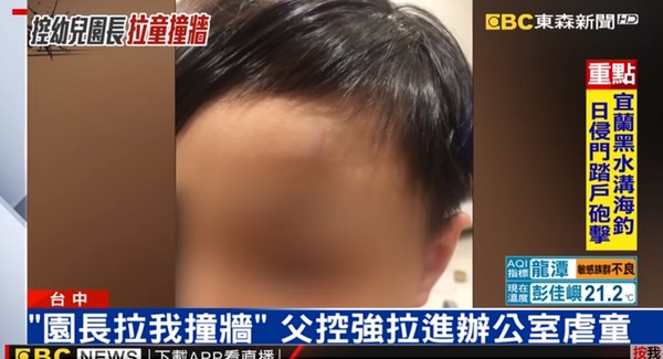 ▲▼   6歲男童頭瘀青疑「園長拉撞牆」　家長控：說小孩出拳打她肚子（圖／翻攝自東森新聞畫面）