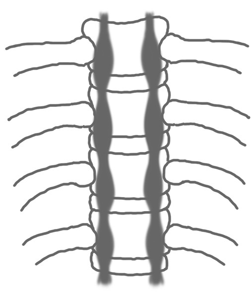 ▲《轉背，最強鬆筋解痛法》書摘。（圖／采實文化提供）