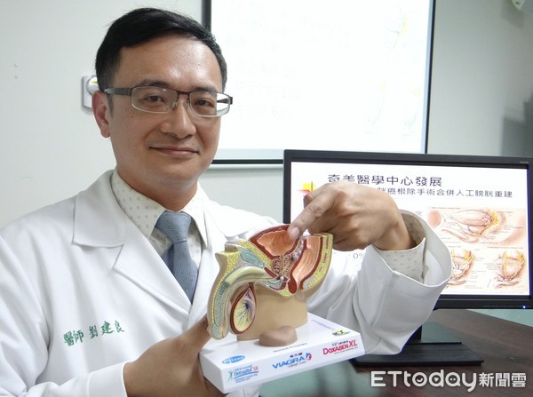 ▲奇美醫學中心泌尿腫瘤科主任劉建良表示奇美醫發展神經保留膀胱癌根除手術併人工膀胱重建.術後保存禁尿及性功能。(圖／奇美醫院提供)