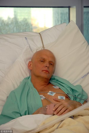 ▲▼俄羅斯前情報員利特維年科（Alexander Valterovich Litvinenko）喝下含有釙-210的茶後病倒，三個星期後不治身亡。（圖／CFP)