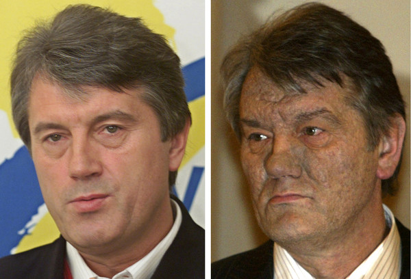 ▲▼烏克蘭前總統尤申科（Yushchenko）在2002年（左），以及2004年遭人下毒後（右）的對比圖。（圖／達志影像／美聯社）