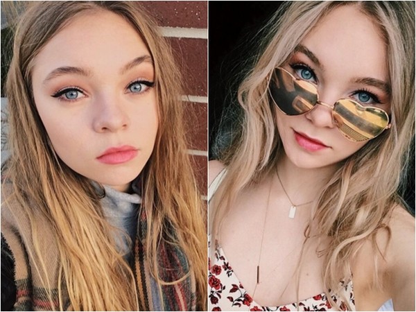 泰勒希克森（Taylor Hickson）臉被碎片割傷。（圖／翻攝自Taylor Hickson IG）