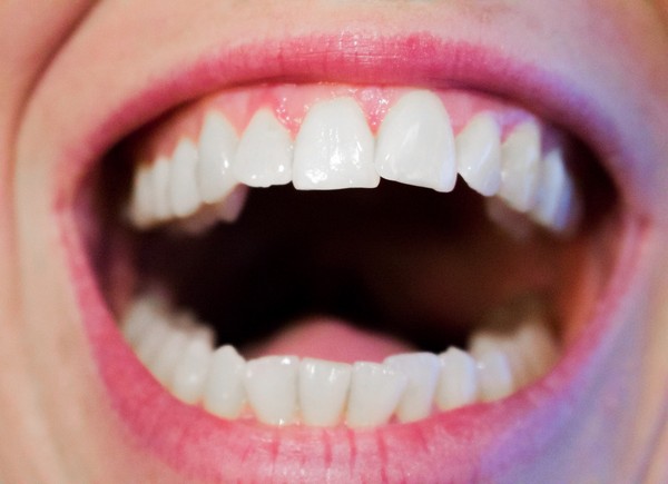 ▲▼女子吃堅果發現一顆不是自己的牙齒。（圖／取自pixabay）