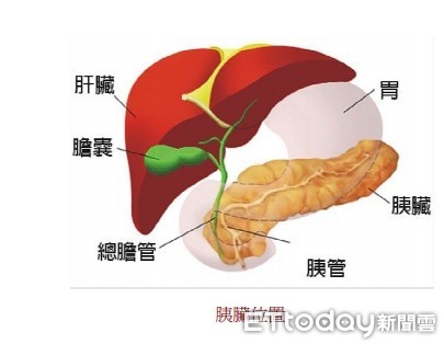 ▲一般民眾對急性胰臟炎的認知較缺乏，當急性胰臟炎發病後的 24小時是很重要的黃金時間。（圖／記者林悅翻攝）