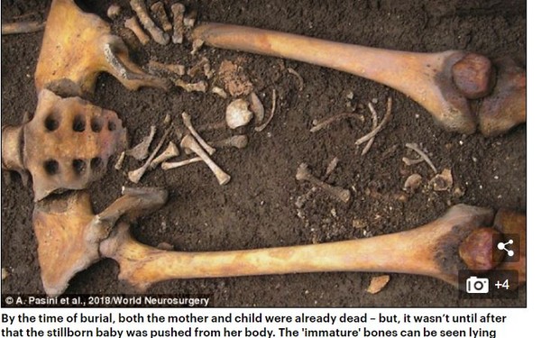 ▲ 義大利出土的女性骨骸腿部內側發現胎兒骨頭，專家認定是「棺材分娩」。（圖／翻攝自《每日郵報》）
