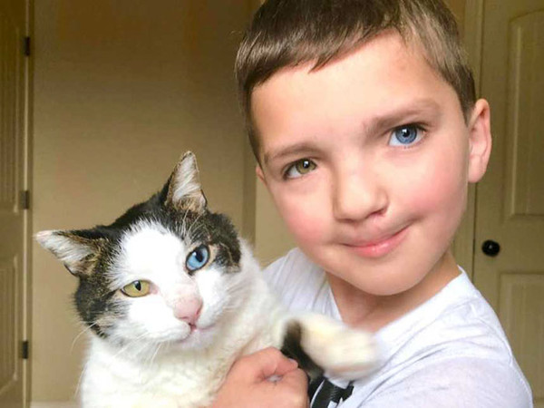 「異色瞳+兔唇」7歲男童與貓（圖／翻攝自Boredpanda）