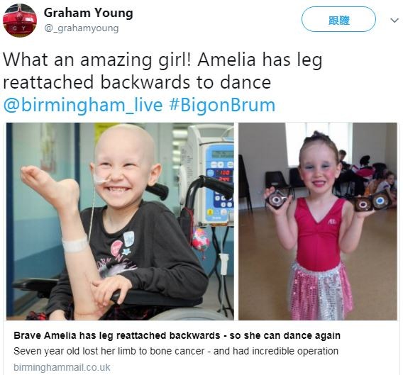 7歲骨癌女童截肢，對即將被切下的左腿揮手道別。（圖／翻攝自Graham Young推特）