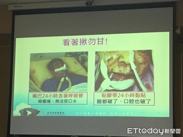 ▲氣切到底有沒有必要。（圖／記者嚴云岑攝）