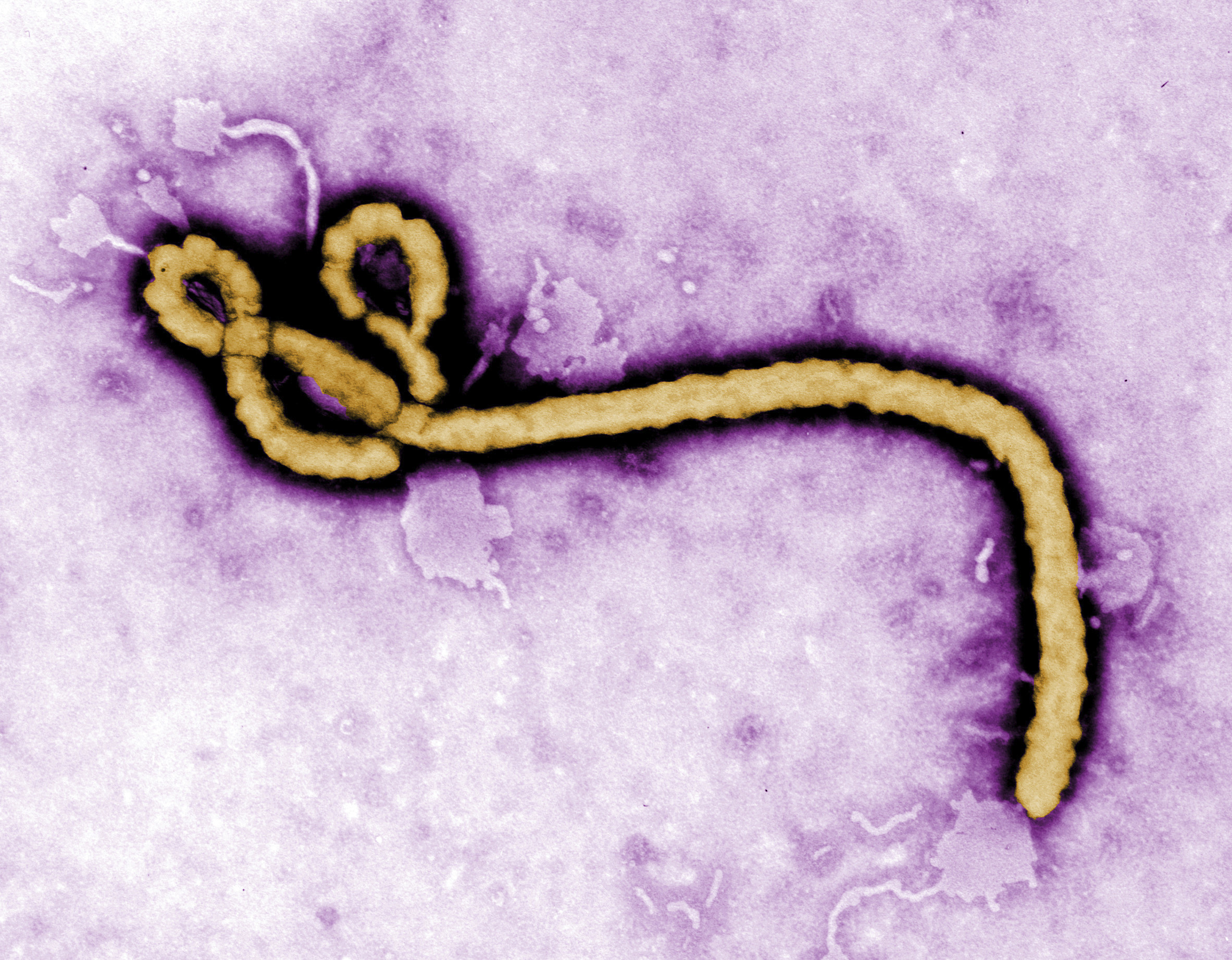 ▲▼ 伊波拉（Ebola）。（圖／達志影像／美聯社）