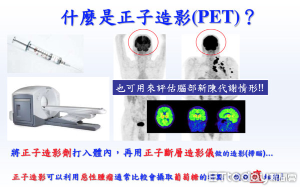 正子影像檢查。（圖／三總提供）