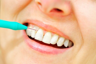 牙刷只能清60%！醫教你用正確用「牙間刷」徹底清口腔