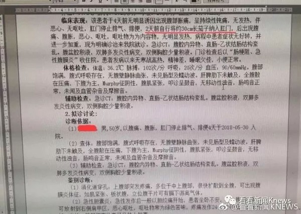 男下體塞30公分茄子「通腸」　真的要頂到心臟了！（圖／翻攝自看看新聞KNEWS的微博）