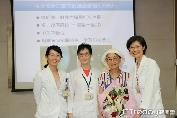 ▲北榮角膜移植大突破！　取後彈力層「缺陷角膜」也能用。（圖／台北榮總提供）