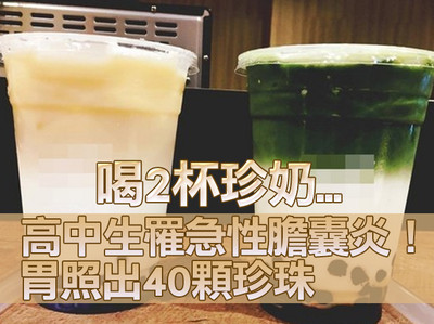 喝2杯珍奶.高中生罹急性胆囊炎!「胃照出40颗珍珠」医惊