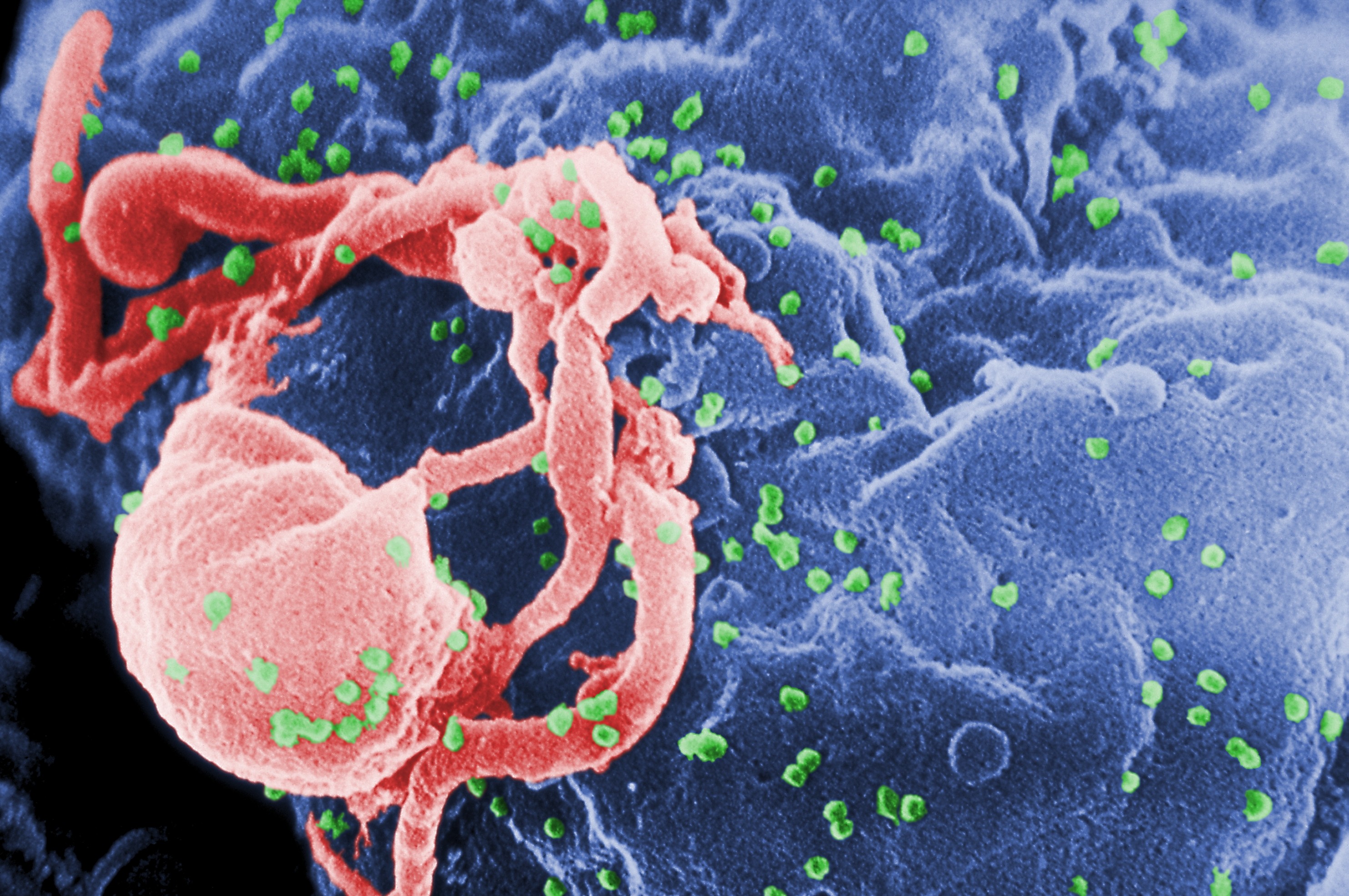 ▲▼HIV愛滋病毒          。（圖／翻攝維基百科）