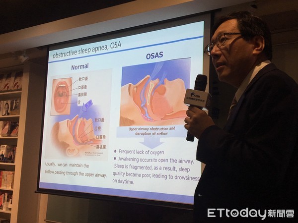 ▲睡眠呼吸中止症。（圖／記者嚴云岑攝）