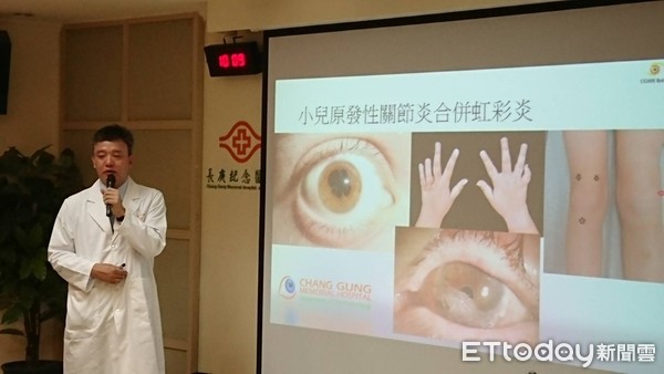 ▲這病讓她21歲看起來像「小學生」　還有一隻眼睛看不到。（圖／記者嚴云岑攝）