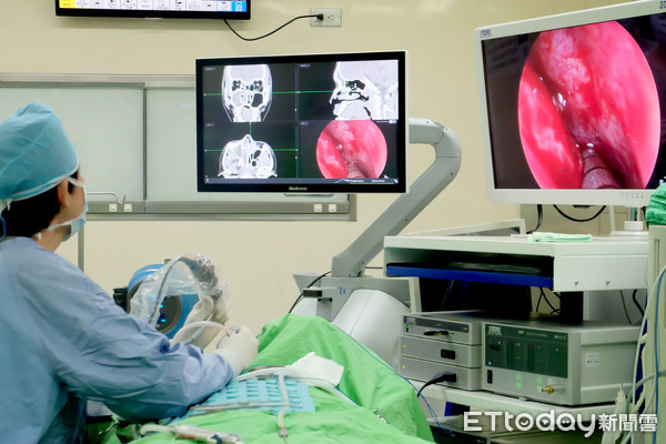 羅東博愛醫院最新型「電磁立體定位導航系統」，同步結合電腦斷層影像與術中3D影像呈現複雜的鼻腔構造，去除病灶快狠準。（圖／記者游芳男翻攝，下同）