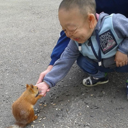 ▲▼哈薩克6歲男童患罕病，外貌如80歲老人。（圖／翻攝自IG／pomosh_ernarchiku）