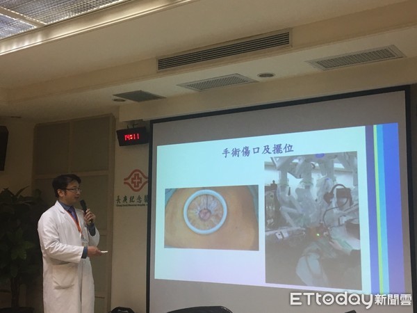 ▲吐血10年才知胃癌二期　醫幫他「摘全胃」卻沒留下任何疤。（圖／記者嚴云岑攝）