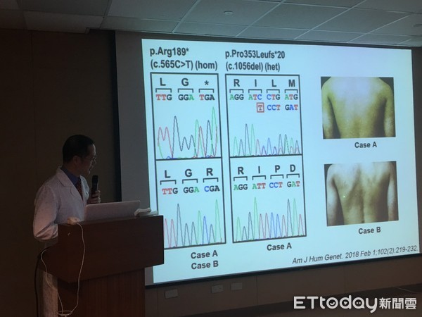▲手腳「黑白斑」被笑沒洗澡　長大才知罕病...全台僅9人有。（圖／記者嚴云岑攝）