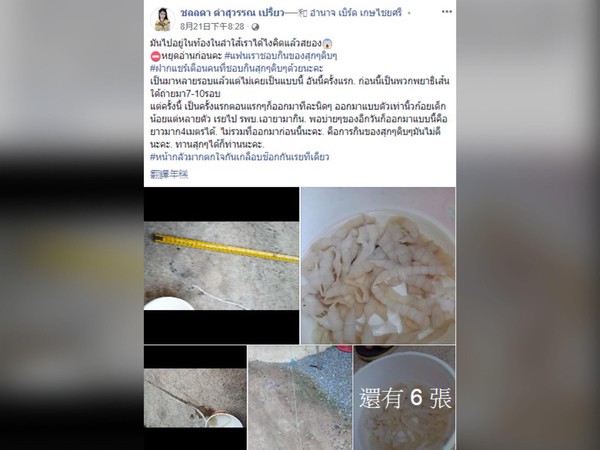 ▲泰國男網友因經常吃生肉，上醫院竟拉出4公尺條蟲。（圖／翻攝自ชลลดา ดำสุวรรณ เปรี้ยว臉書）
