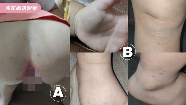 ▲▼9大腸病毒迷思。（圖／kingnet國家網路醫藥）