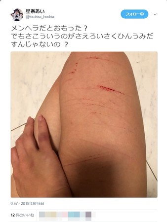 ▲星奈愛被男友劈腿崩潰，在推特上傳自殘照。（圖／翻攝自推特）