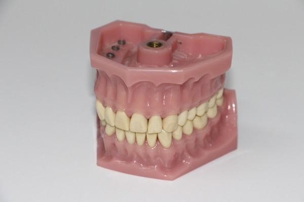▲▼假牙,牙齒。（圖／翻攝自pixabay）