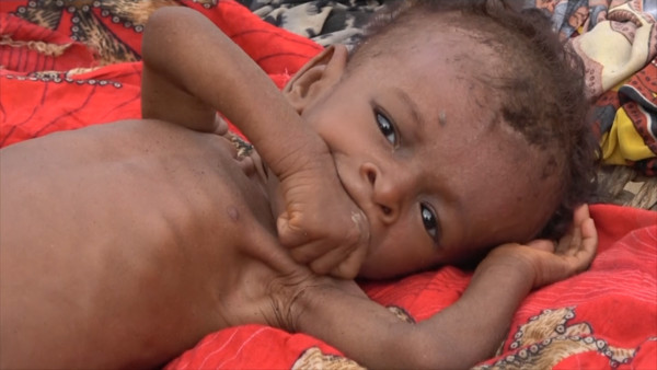 ▲▼葉門戰火狂轟幼童飢荒。（圖／翻攝自AP影片）
