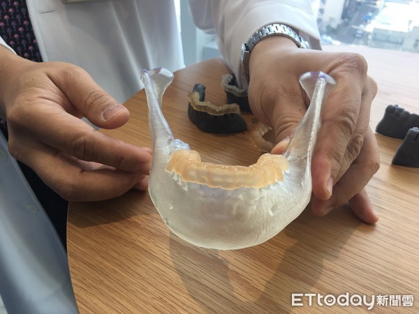 ▲經口切甲狀腺不留疤　北榮更首創「安全裝置」避免下巴麻。（圖／記者嚴云岑攝）