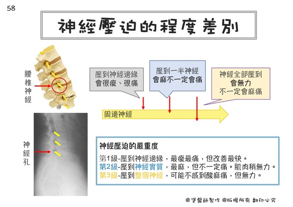 ▲一張圖秒懂痠痛麻與神經壓迫（圖／堡醫師製作）