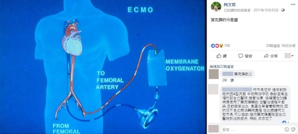 ▲▼前台大醫院醫師、台北市長柯文哲分享葉克膜示意圖。（圖／翻攝自柯文哲臉書粉絲專頁）