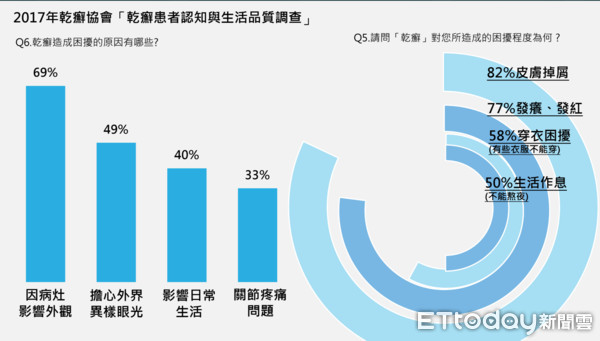 ▲這病讓頭皮像「曬傷」　狂掉頭皮屑試衣服被店員「青」。（圖／公關提供）