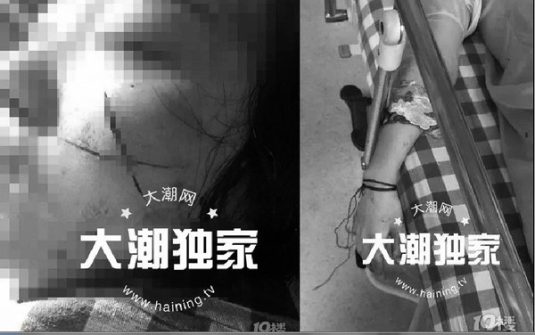 刀片在女友臉割「2個大X」　渣男怕戴綠帽：毀容就沒人愛了。（圖／翻攝自大陸《海寧大潮網》）