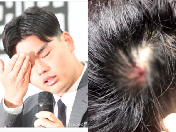 ▲▼16歲韓男團遭棍棒暴打50次　「頭部出血」全身紫色傷照曝光（圖／翻攝自JTBC）