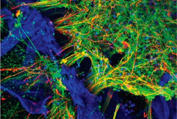 ▲腦組織培養：阿滋海默症患者的神經元(綠色)，充填了絲質膠原蛋白(藍色)的絲蛋白和膠原蛋白(藍色)的多孔基質。紅色的是星形膠質細胞。(圖／翻攝自塔夫斯大學官網)