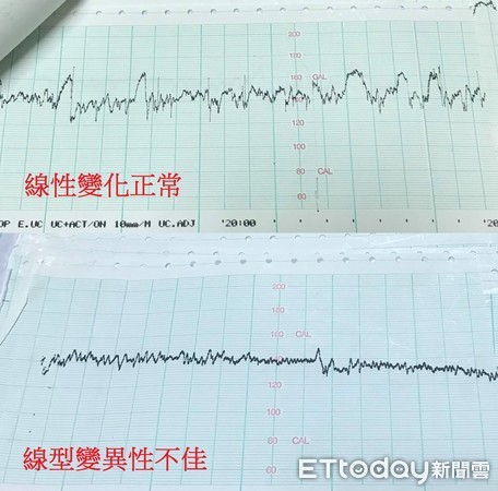 ▲▼ （圖／何延慶醫師提供）