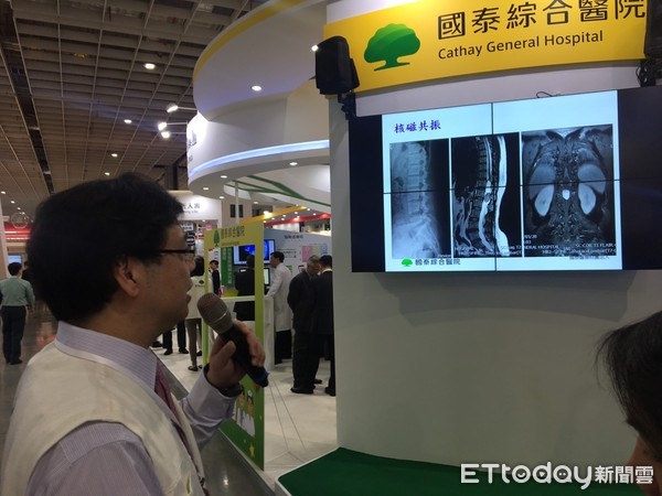 ▲醫療科技展「機器人」大拼比　這醫院導航開腦創全球首例。（圖／記者嚴云岑攝）