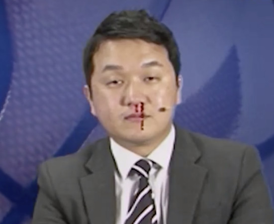 ▲南韓主播報NBA噴鼻血。（圖／翻攝自Facebook／SPOTV 스포티비）