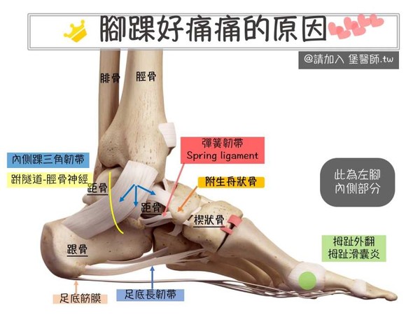 脚踝扭伤拉伤脚踝好痛怎么办 医师图文解说 雪花台湾