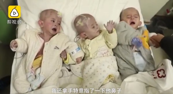 ▲▼貴州農村婦產下3胞胎，3個孩子皆無肛門。（圖／翻攝《梨視頻》）