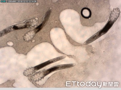 她臉紅癢…醫驚見「8腳蟲蟲爬滿臉」啃咬！恐怖徵兆一次看