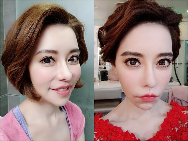 斯容小丑鼻不見了 整型60次只後悔動這裡 留一生後遺症 Ettoday星光雲 Ettoday新聞雲