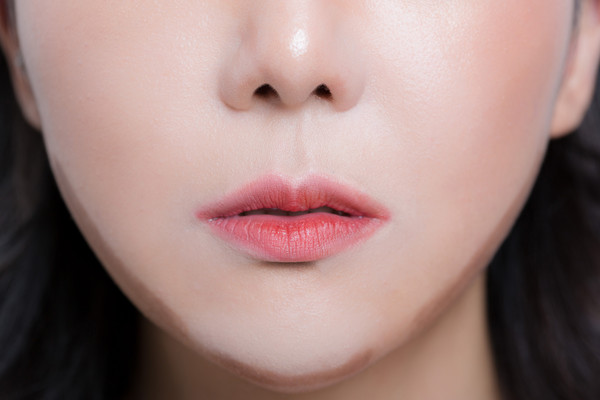 轮廓修饰运用 「修饰无下巴与嘴巴突出」