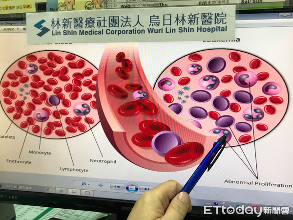 ▲暴瘦10公斤，男患「慢性骨髓白血病」。（圖／記者陳玉翻攝）