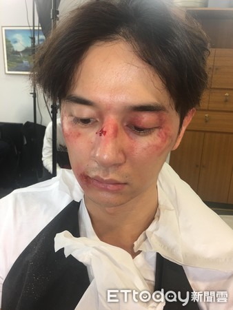 男生打架受伤帅气图片图片