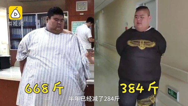 ▲▼ 中國第一胖,王浩楠,中東濟南。（圖／翻攝自梨視頻）