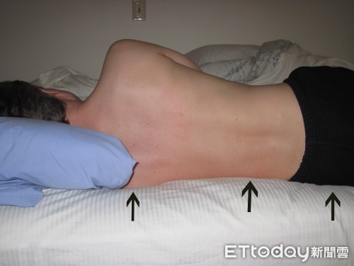 ▲肩頸總是痛，挑對枕頭睡覺好重要。（圖／南投醫院提供）