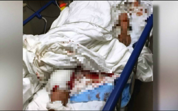 ▼阿肯色州27歲女子被10隻狗瘋狂圍住亂咬。（圖／翻攝自臉書）